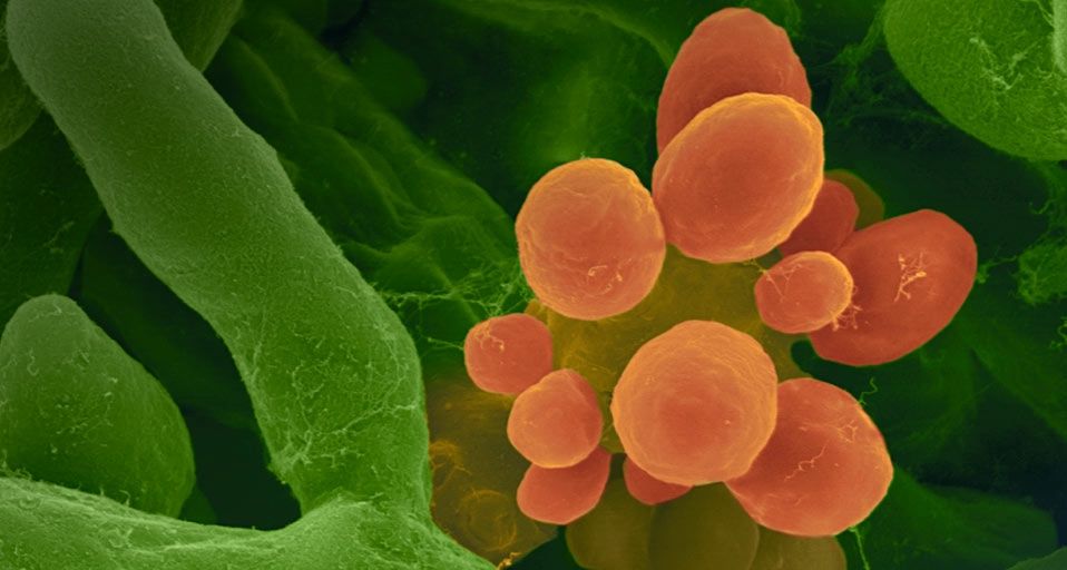 Common indoor/allergenic mold