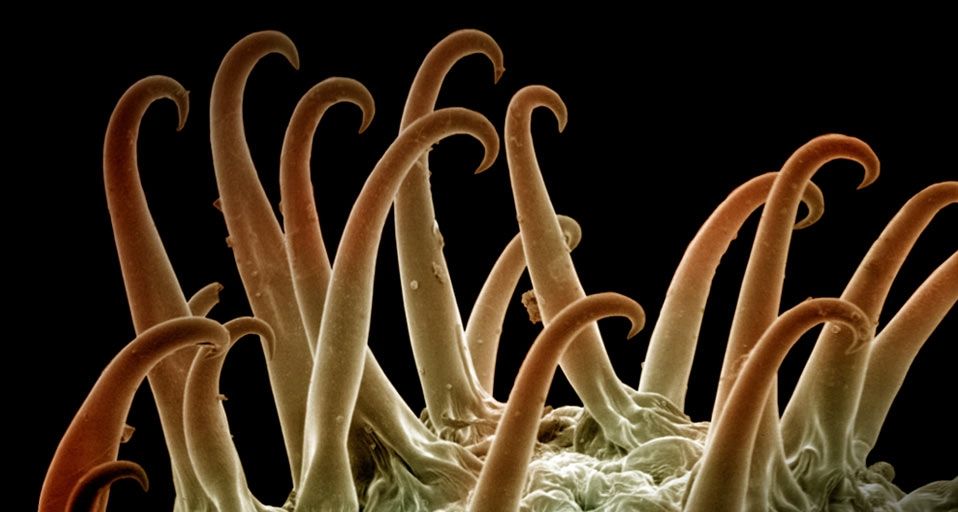 Scanning electron micrograph photo of Cocklebur (Xanthium) seeds