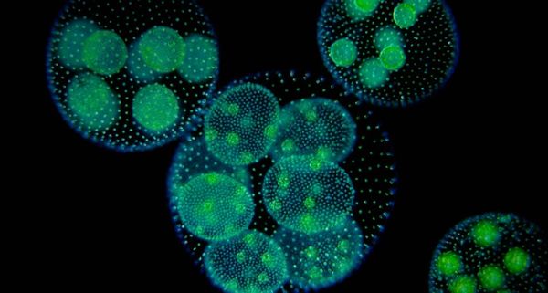 Green Algae (Volvox Aureus) photographed using darkfield magnification technique
