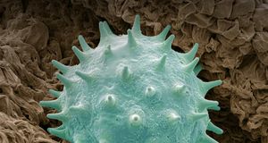 Colored scanning electron micrograph (SEM) of a pollen grain from a Chinese hibiscus --Science Photo Library Rf/Photolibrary &copy; (Bing United States)