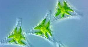 Light micrograph image of Green Algae Staurastrum -- Visuals Unlimited/Corbis &copy; (Bing Australia)
